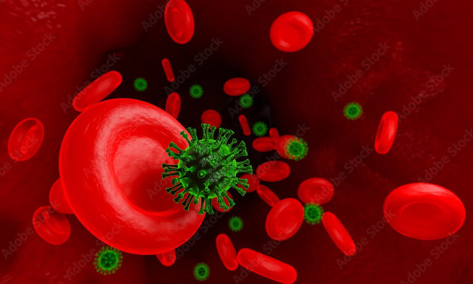 Trombose pode se manifestar durante e após a infecção do Sars-CoV-2